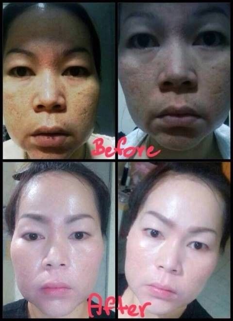 รูปภาพสินค้า