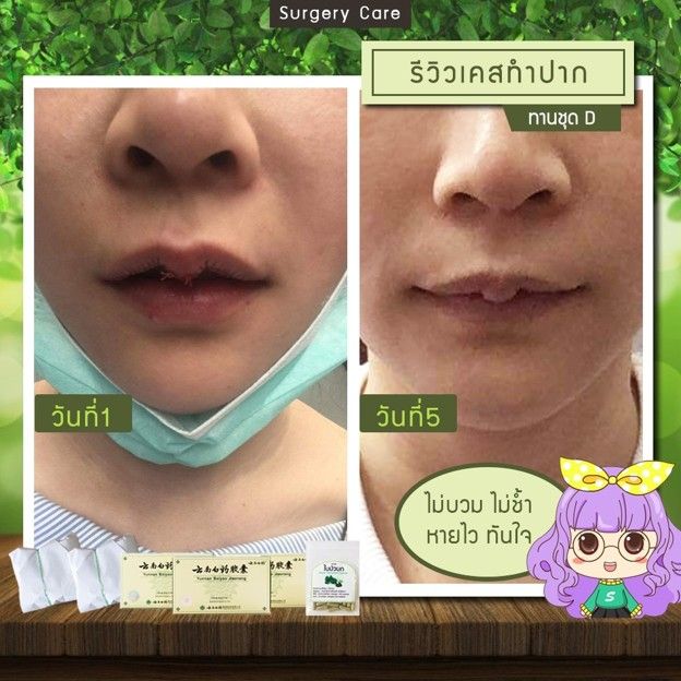 รูปภาพสินค้า