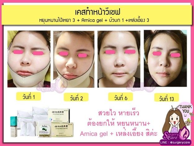 รูปภาพสินค้า