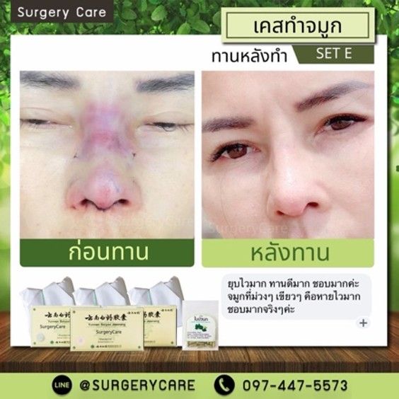 รูปภาพสินค้า