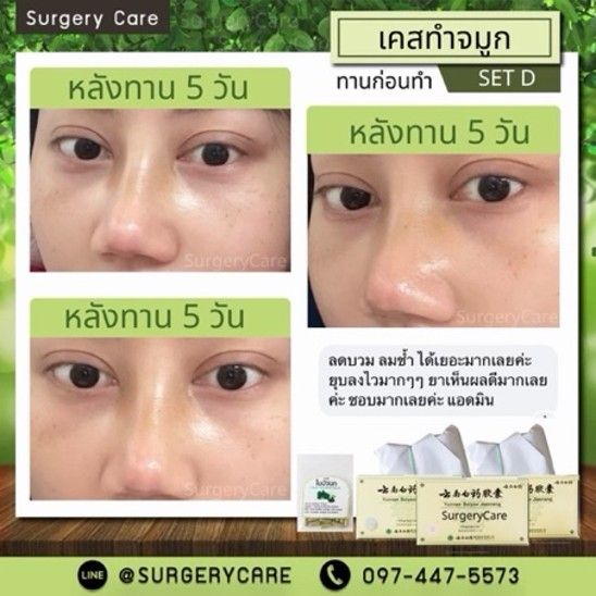รูปภาพสินค้า